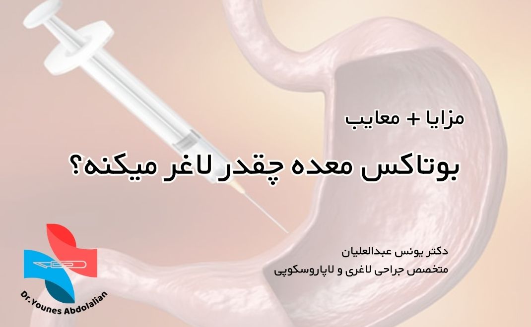 پوستر بوتاکس معده