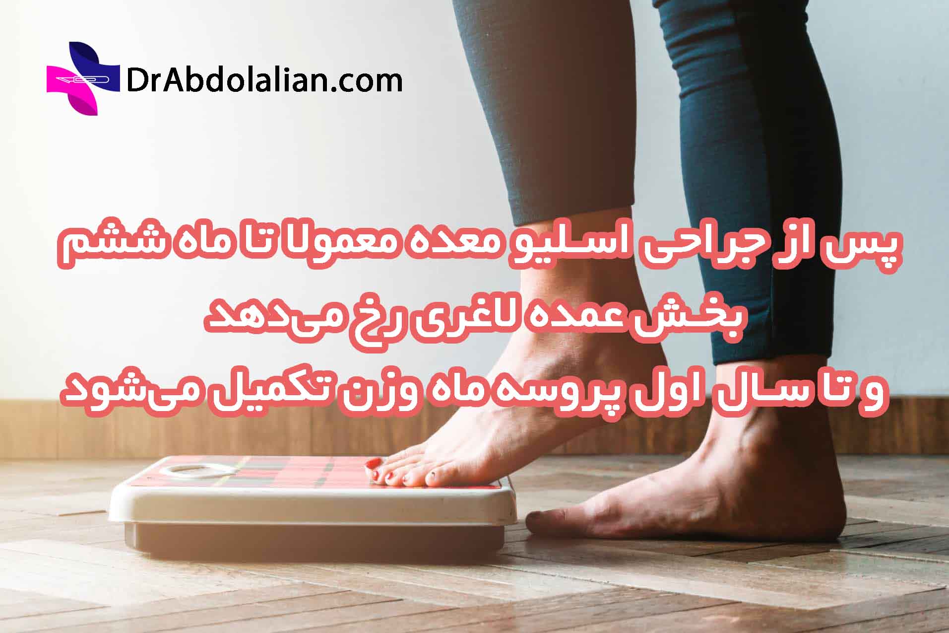مسیر لاغری پس از اسلیو معده