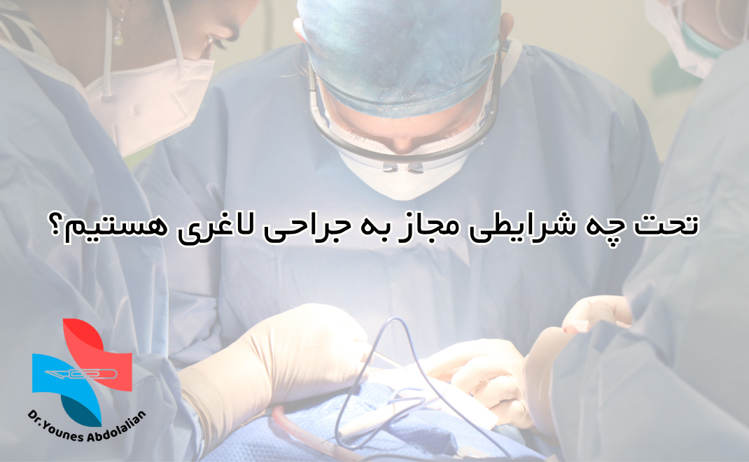 کاندید جراحی لاغری